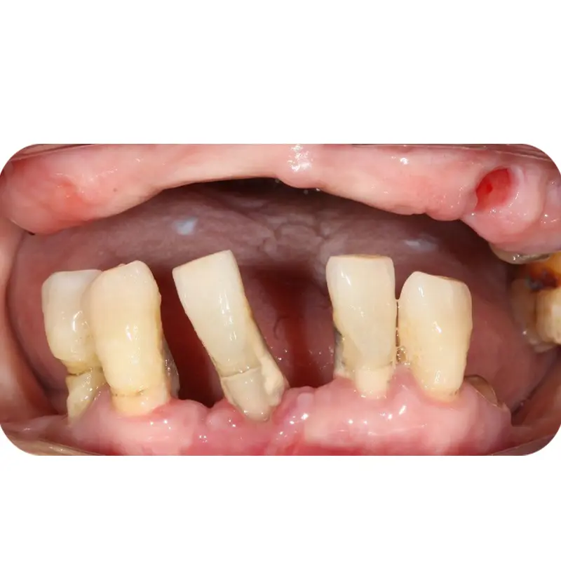 Trước khi điều trị