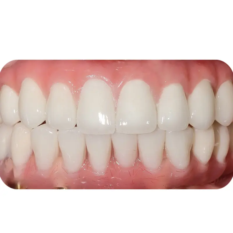 Sau khi điều trị