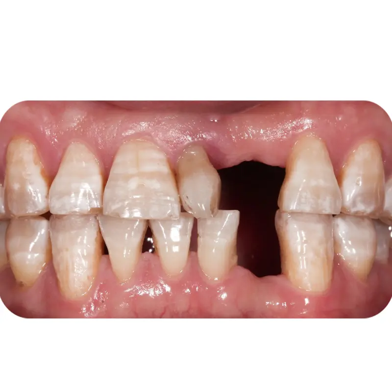 Trước khi điều trị